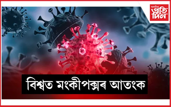'মংকীপক্স'ক লৈ বিশ্বজুৰি জৰুৰীকালীন অৱস্থা ঘোষণা...